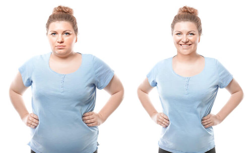 Mommy Makeover