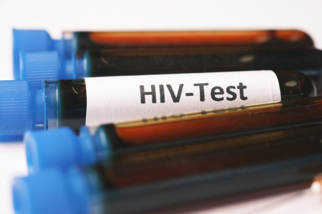As infections rise in 2024, who will support the immediate deployment of new HIV JAB?  