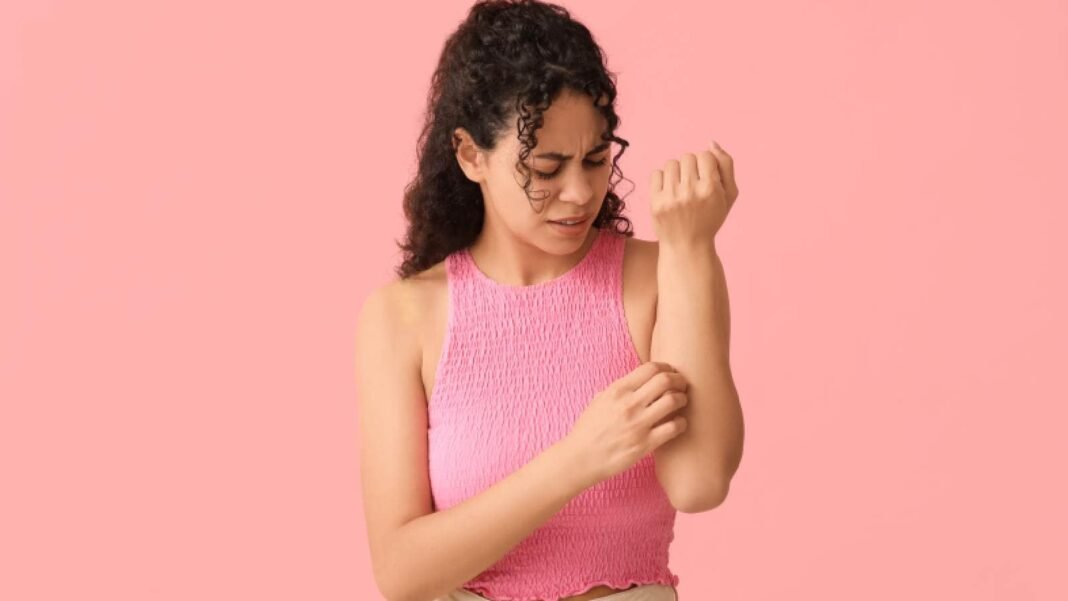 Cucumber to coriander: 10 home medications for fever rashes to soothe the skin  