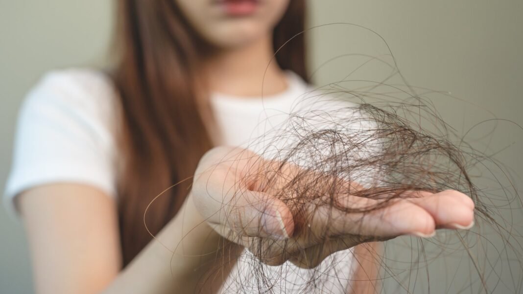 hair-fall.jpg Hair growth can slow down in winter: a dermatologist explains why and what to do about it