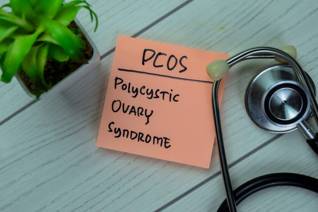 polycystic-ovary-syndrome.jpg One of the world's most misunderstood women's health conditions has recently been renamed